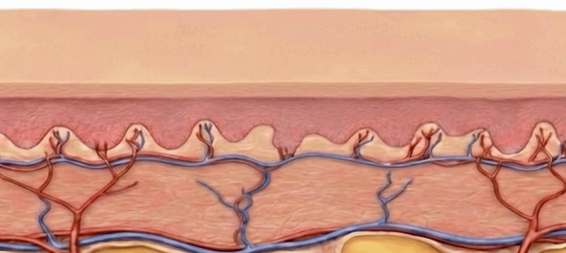 탄력섬유의 감소