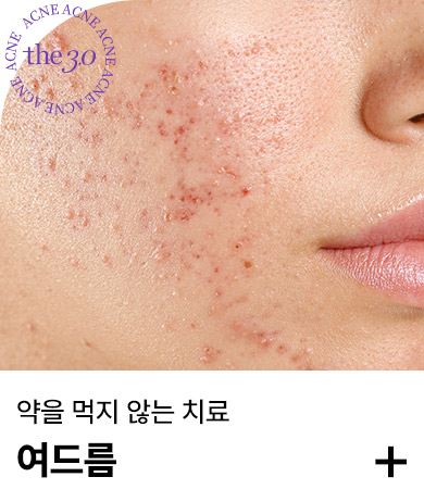 여드름