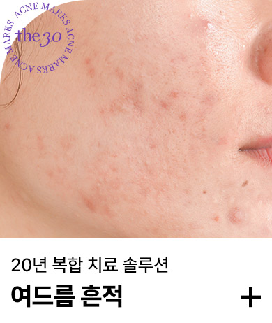 여드름흔적