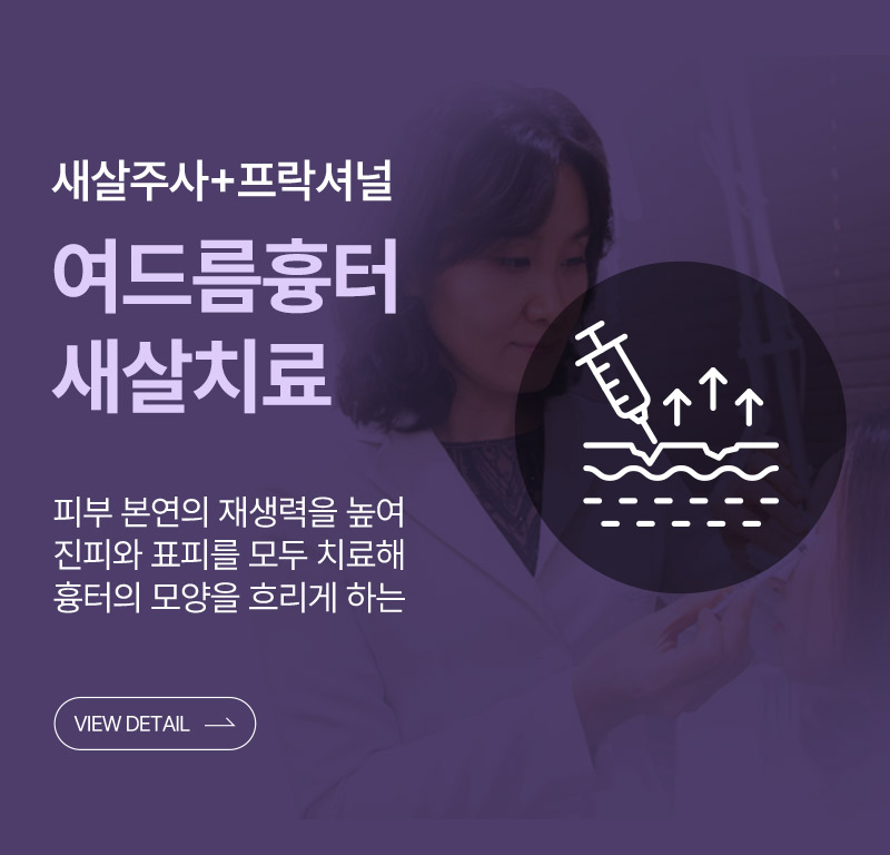 여드름흉터치료