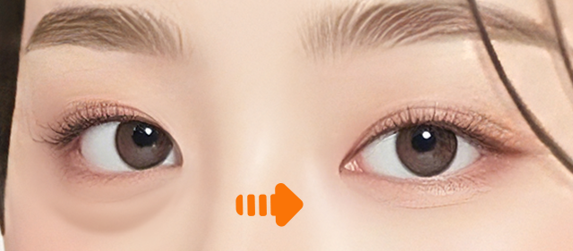 피부 균형 회복