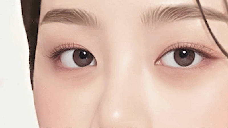 히든주사 & 혈관 축소 레이저