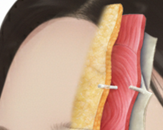 이마 미간 피부 구조 해부학